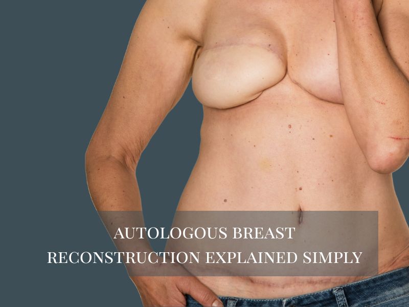 Autologous Breast Reconstruction Explained Simply