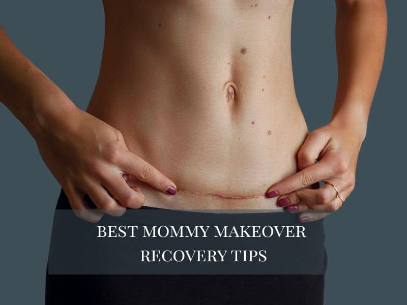 Best mommy makeover recovery tips