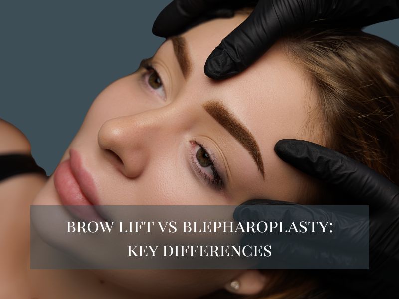 Brow Lift vs Blepharoplasty Key Differences