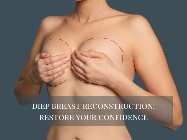 DIEP Breast Reconstruction- Restore Your Confidence