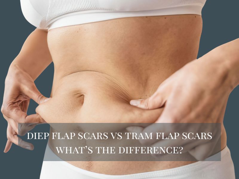 DIEP Flap Scars vs TRAM Flap Scars What’s the Difference