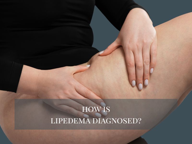 How Is Lipedema Diagnosed