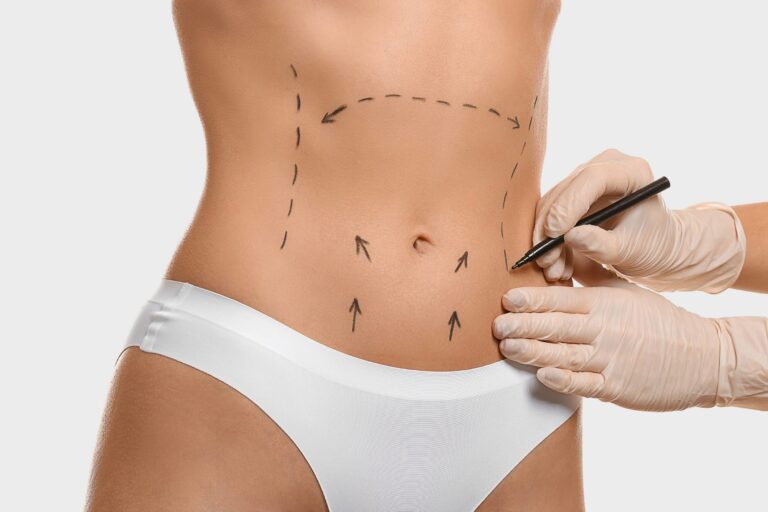 How Much Does Fat Transfer Cost