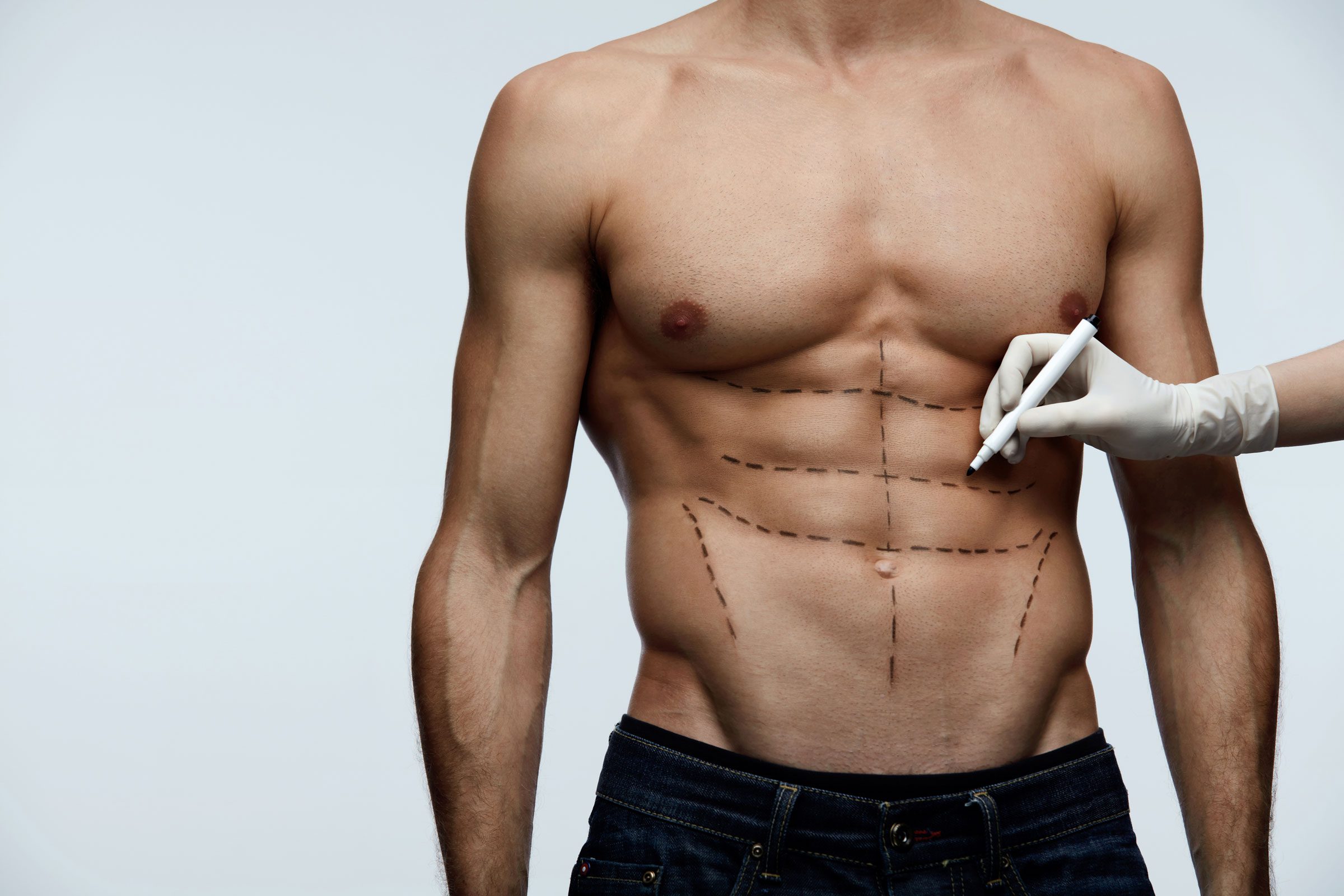 How Much is Liposuction for Men