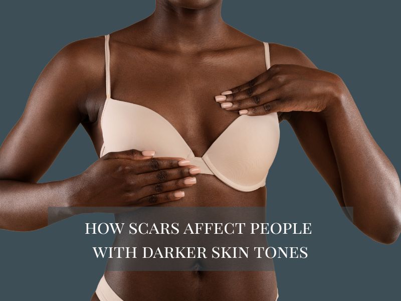 How Scars Affect People with Darker Skin Tones