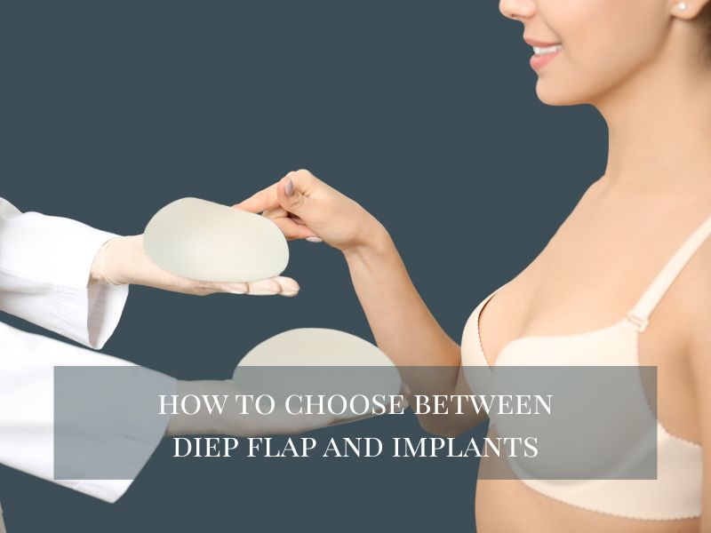 Breast Reconstruction Diep Flap vs Implants What’s the Difference