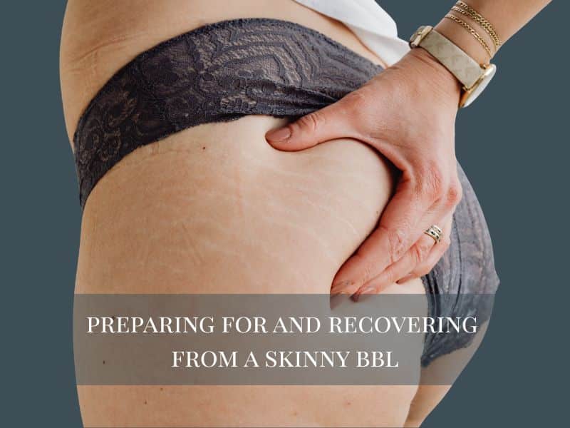 Preparing for and Recovering from a Skinny BBL
