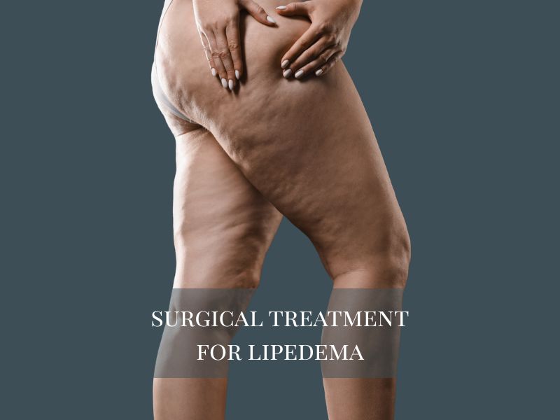 Surgical Treatment for Lipedema