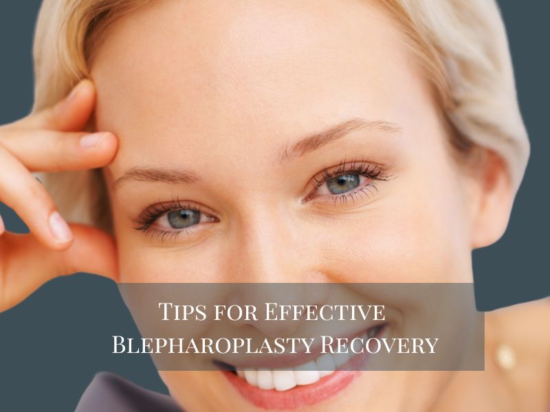 Tips for Effective Blepharoplasty Recovery
