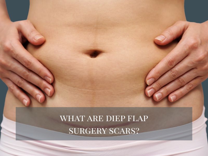 What Are DIEP Flap Surgery Scars