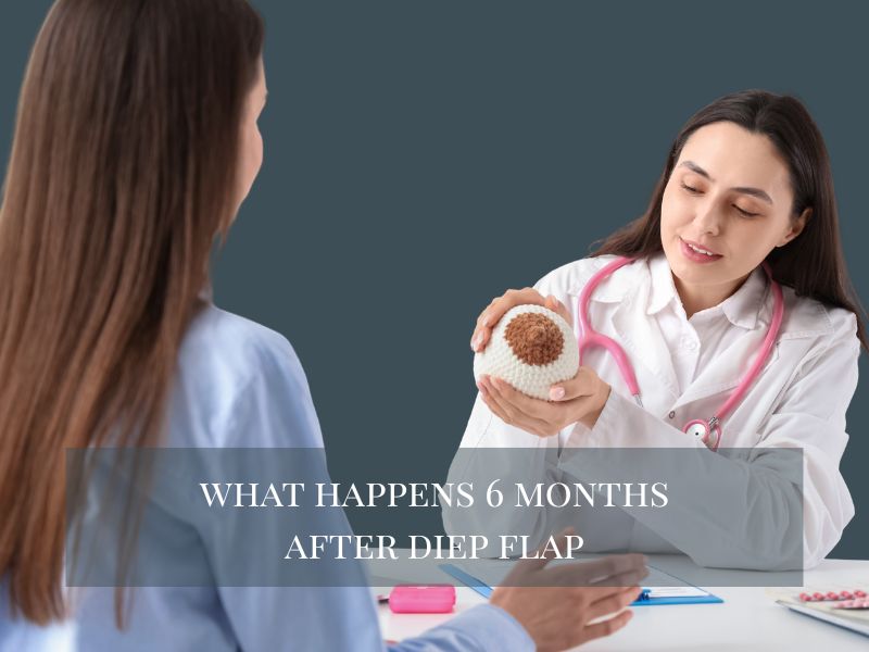 What Happens 6 Months After DIEP Flap