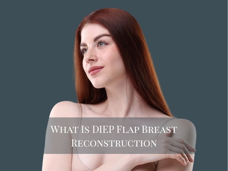 What Is DIEP Flap Breast Reconstruction