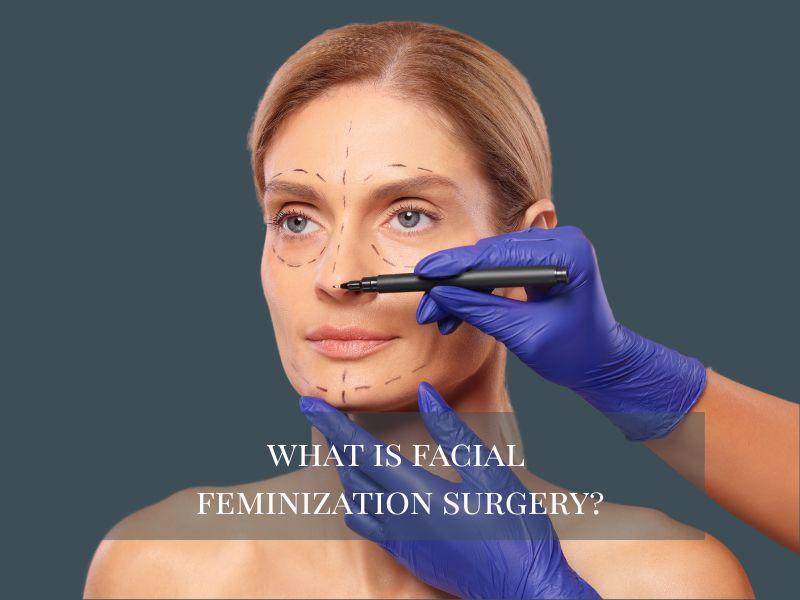What is Facial Feminization Surgery?