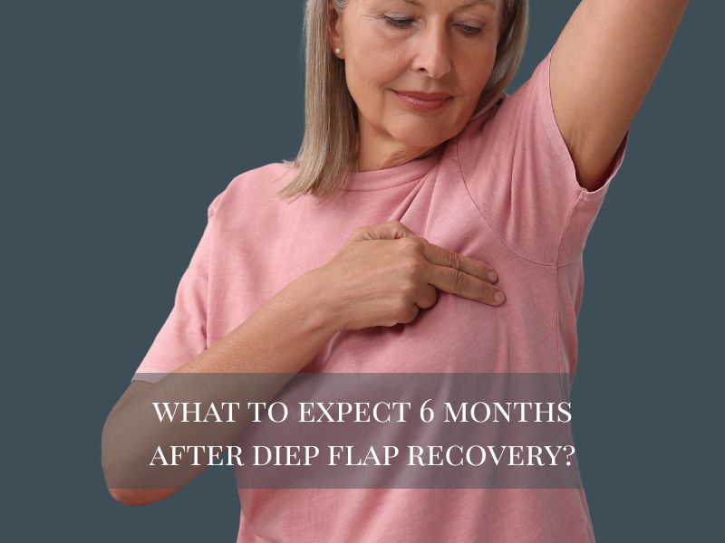What to Expect 6 Months After DIEP Flap Recovery