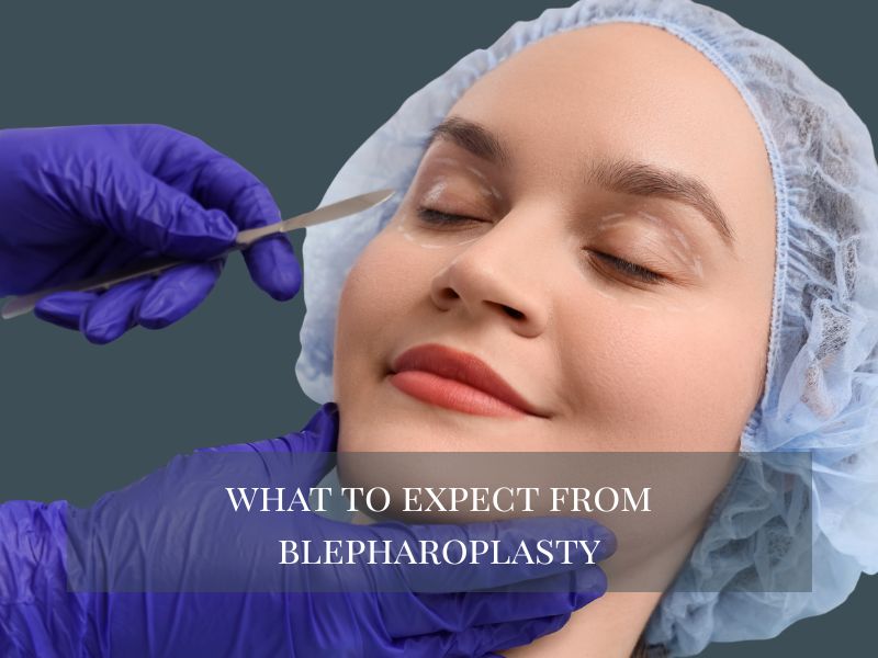 What to Expect from Blepharoplasty
