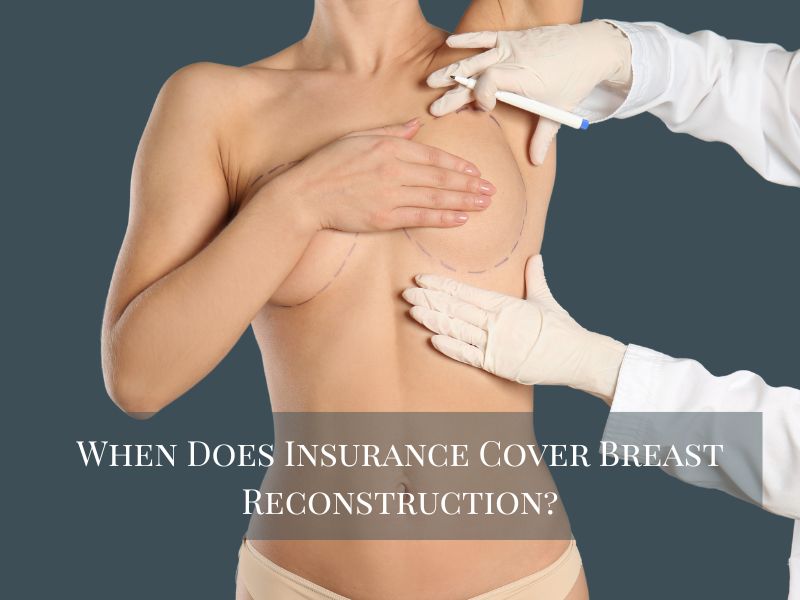 When Does Insurance Cover Breast Reconstruction