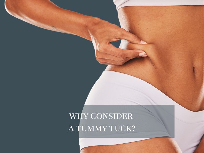 Why Consider a Tummy Tuck