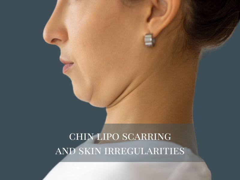 Chin Lipo Scarring and Skin Irregularities