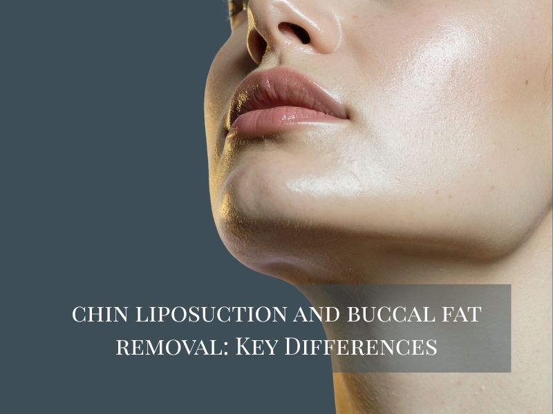 chin liposuction and buccal fat removal Key Differences