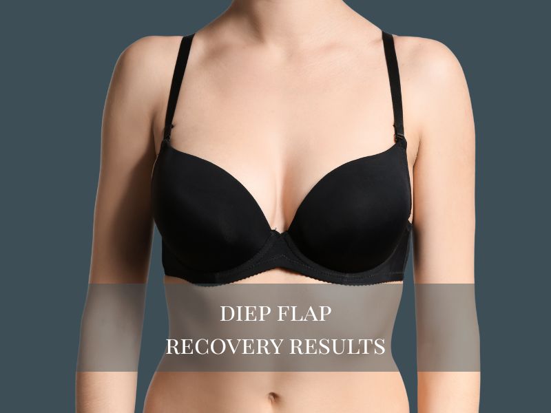diep flap recovery results