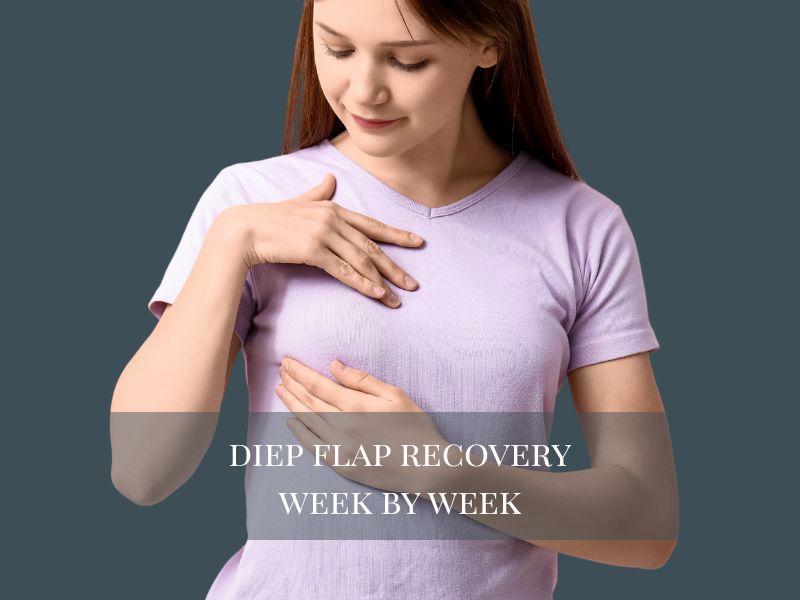 diep flap recovery week by week