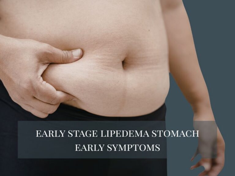 early stage lipedema stomach early symptoms