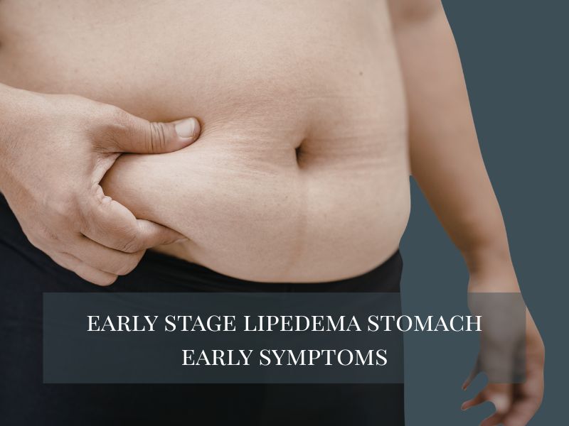 early stage lipedema stomach early symptoms