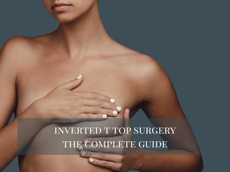inverted t top surgery the complete guide