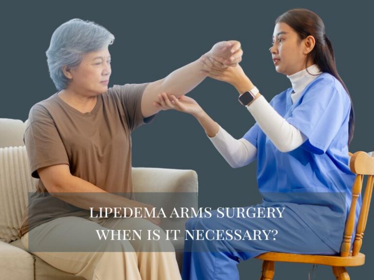 lipedema arms surgery when is it necessary