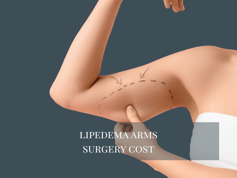 lipedema arms cost