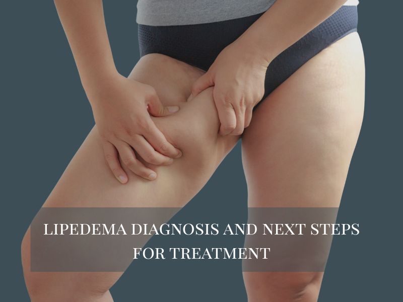lipedema diagnosis and next steps for treatment