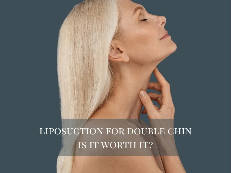 Liposuction For Double Chin: Is It Worth It