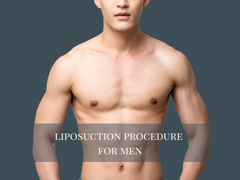 liposuction procedure for men