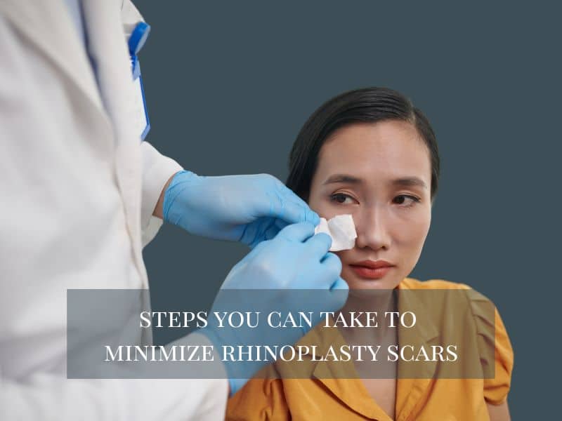 steps you can take to minimize rhinoplasty scars