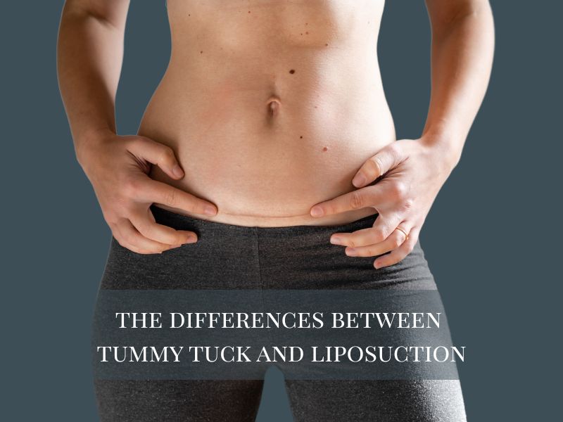 the differences between tummy tuck and liposuction