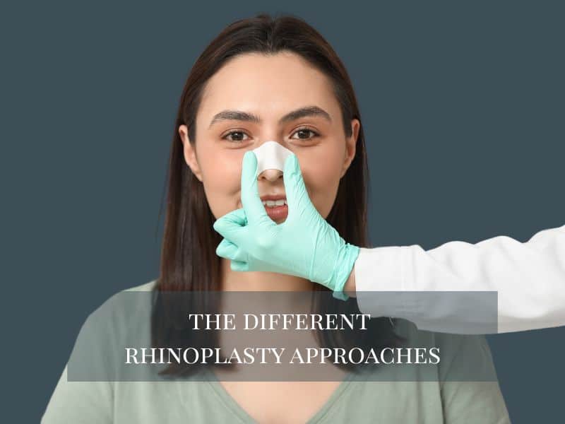 the different rhinoplasty approaches