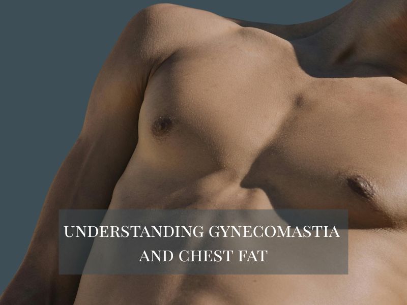 understanding gynecomastia and chest fat
