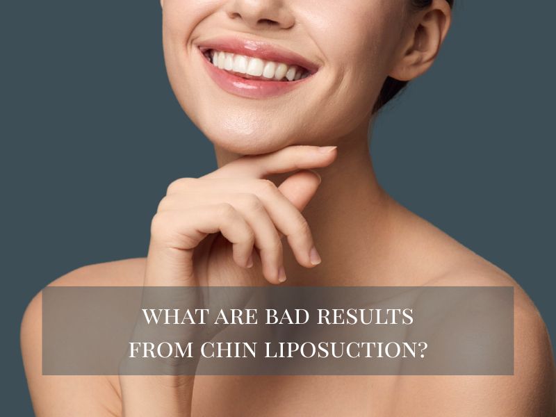 Woman smiling with chin question overlay