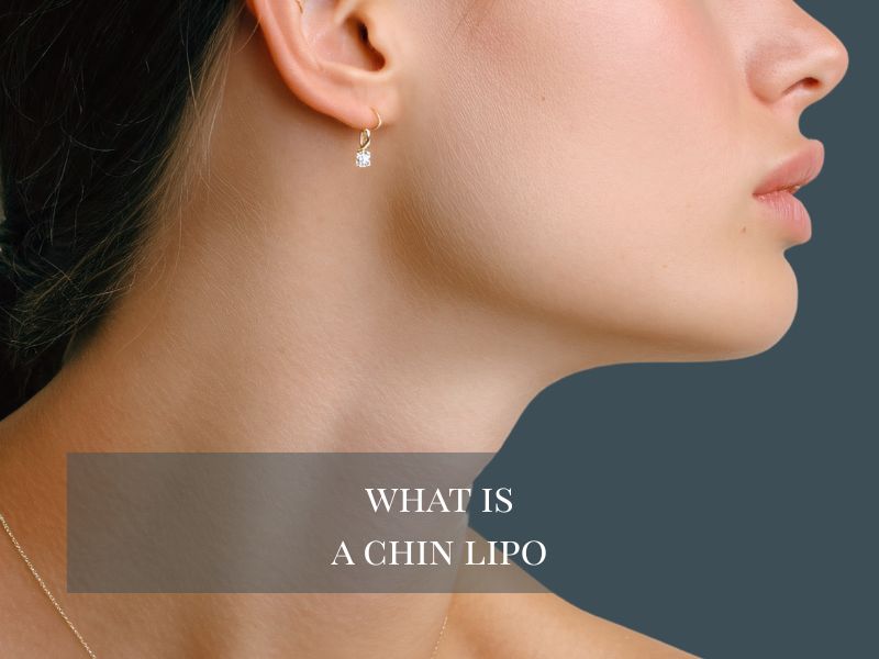 What is a Chin Lipo