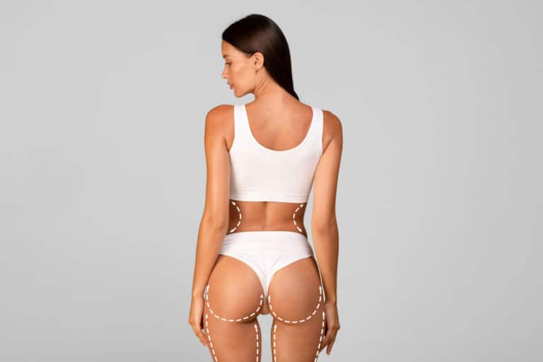 what is a skinny bbl surgery