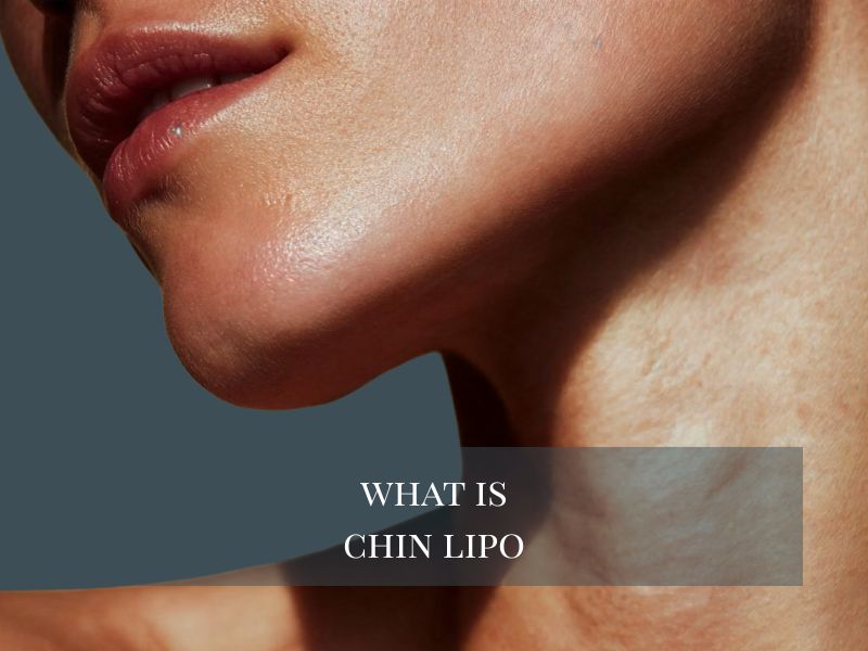 What Is Chin Lipo