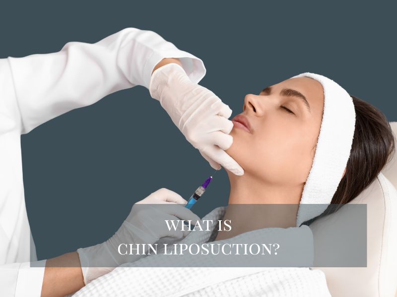 what is chin liposuction