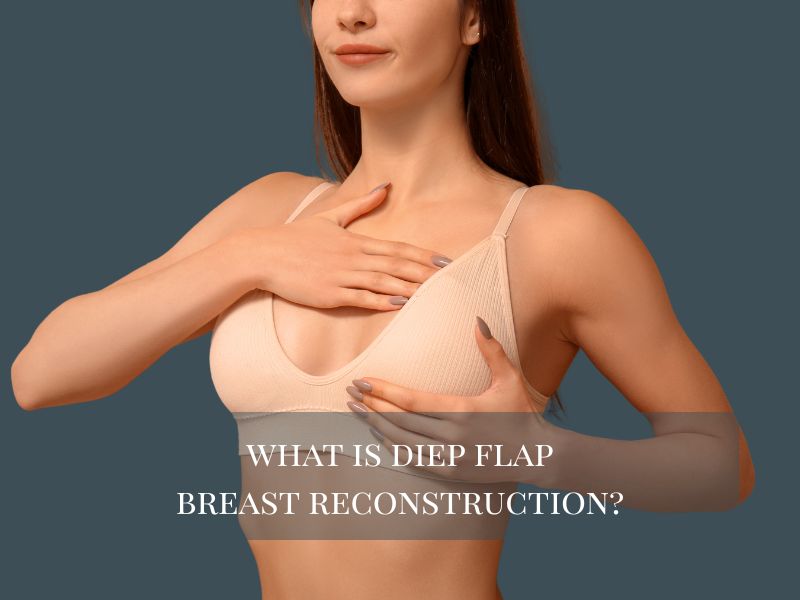what is diep flap breast reconstruction