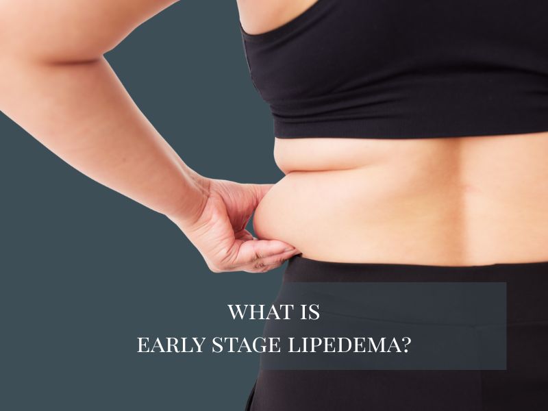 what is early stage lipedema