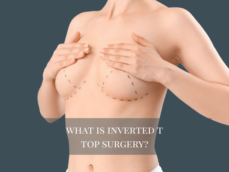 what is inverted t top surgery