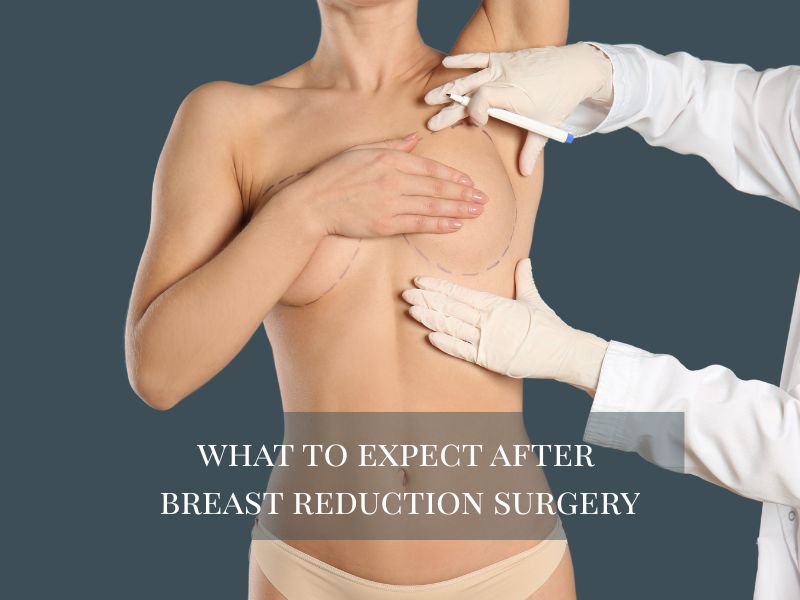 what to expect after breast reduction surgery