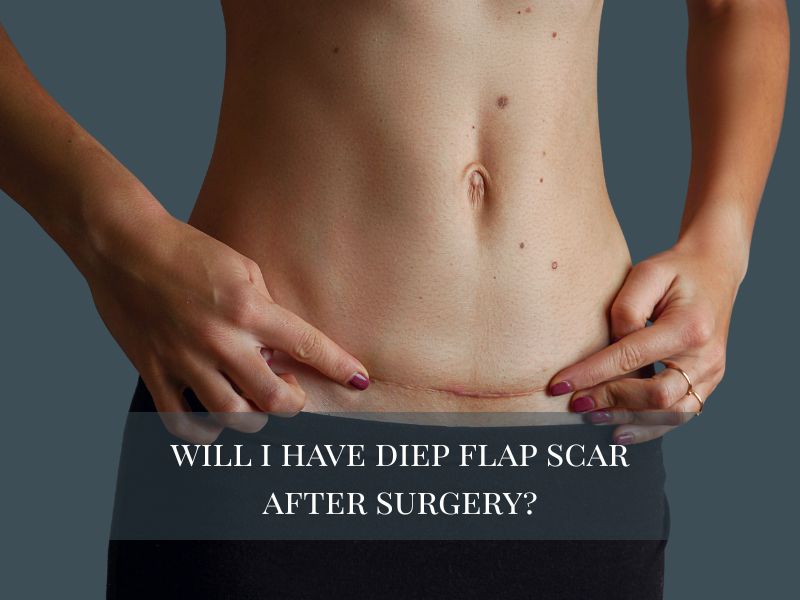 will i have diep flap scar after surgery